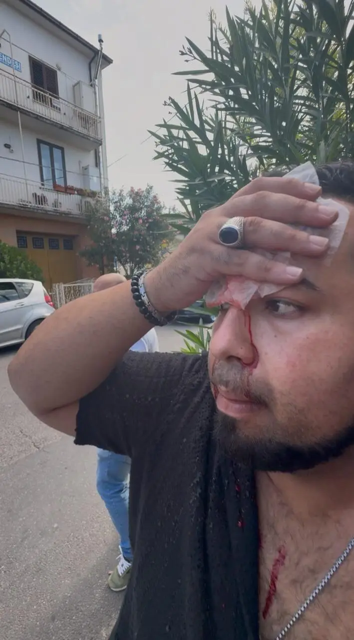 Il ragazzo aggredito