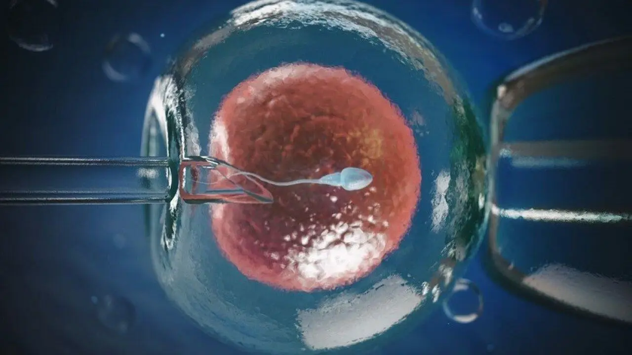 Fecondazione assistita