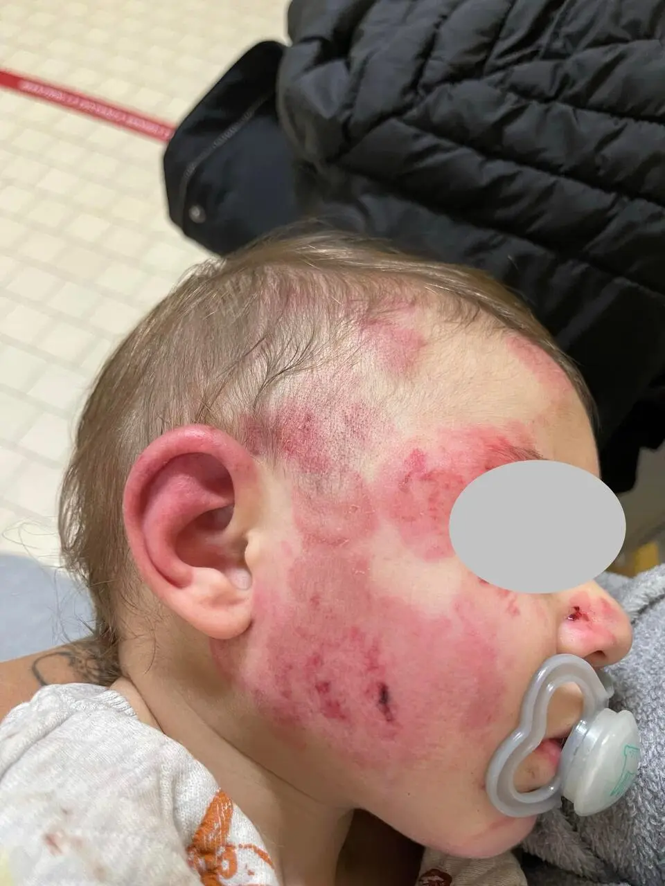 Gabriele in braccio alla mamma nella corsia dell’ospedale