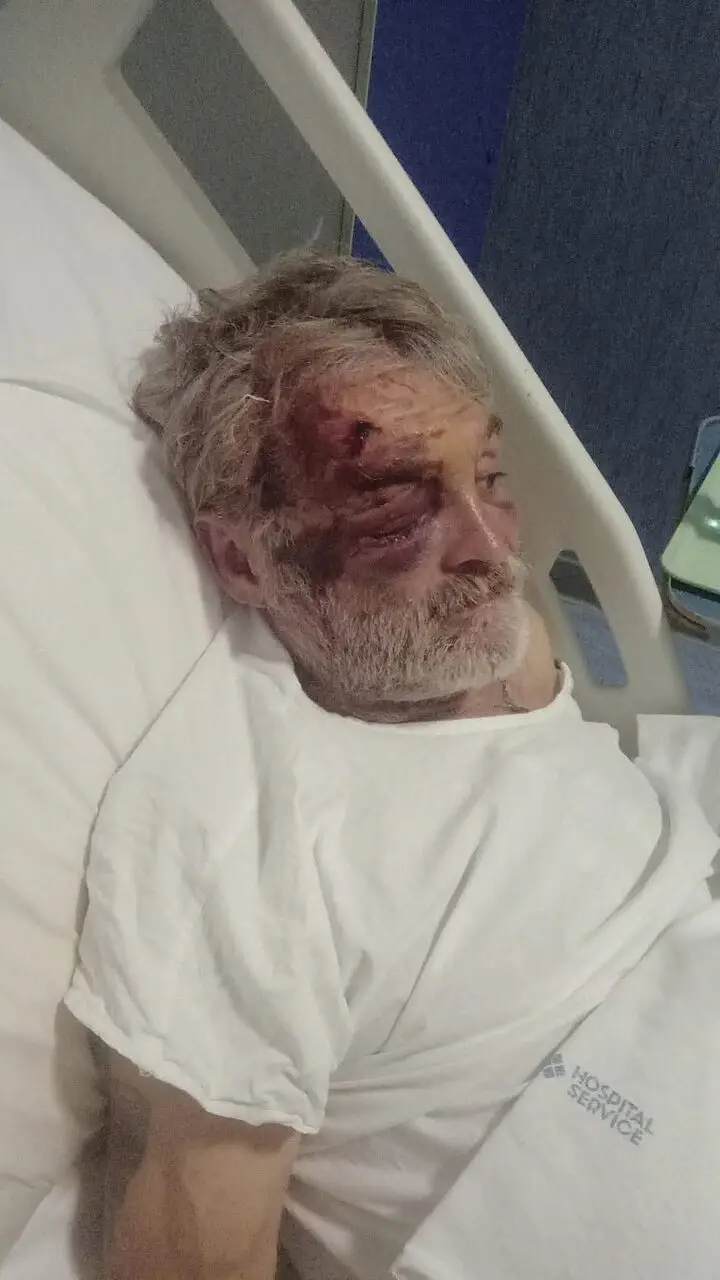 Cristian ferito in ospedale