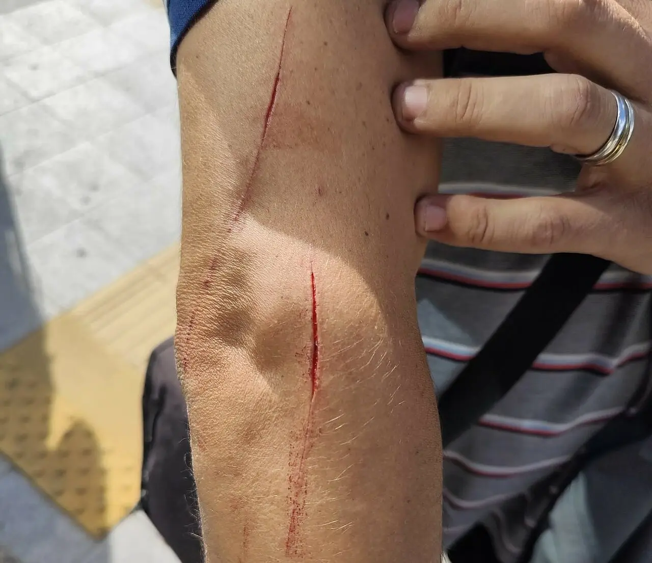 L'autista ferito con un coltello
