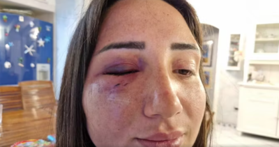 gaia aggredita a pozzuoli