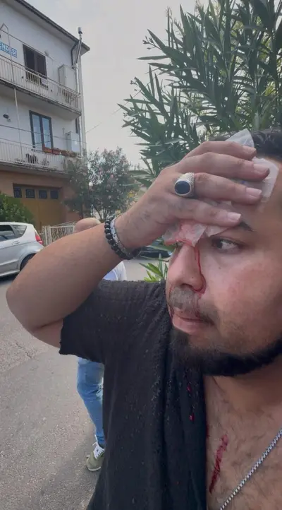 Il ragazzo aggredito