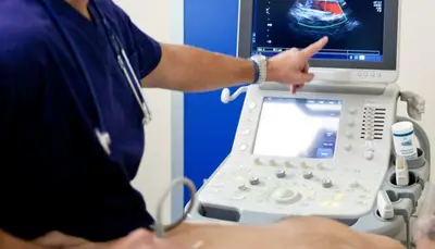 Ecodoppler - immagine di repertorio