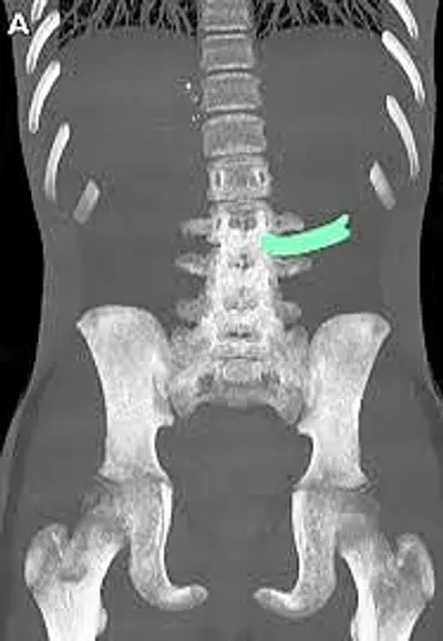 radiografia