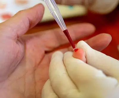 Prelievo di sangue dal dito