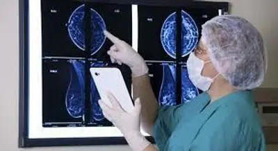 Tumore seno nuova terapia a bersaglio molecolare