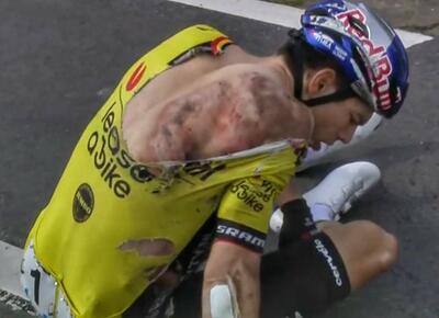Wout van Aert dopo la caduta alla Dwars door Vlaanderen 2024 ©actu.cyclisme via IG
