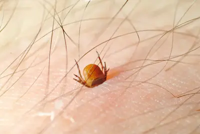 Una minuscola zecca, portatrice della malattia di Lyme © MedicalFacts.it