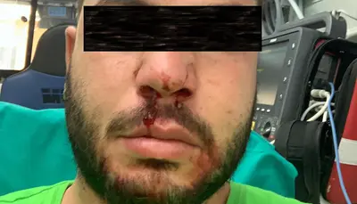 Il lavoratore aggredito a Palagiano