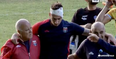 Pietro Cianci esce dopo lo scontro aereo con un calciatore avversario