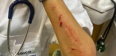 La dottoressa aggredita e ferita al Pronto soccorso